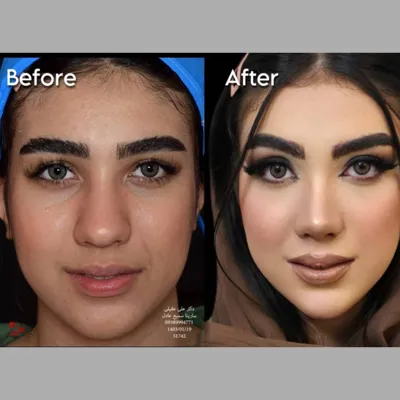 دکتر جراحی بینی در تهران