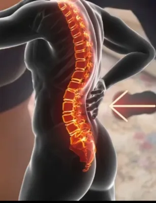 دیسک وسیاتیک بدون عمل جراحی