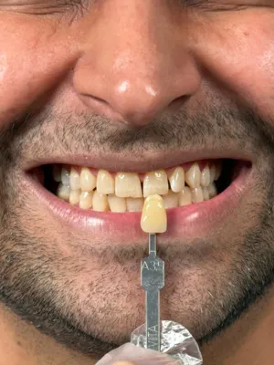 بهترین دندانپزشک زیبایی شیراز