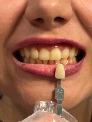 بهترین دندانپزشک زیبایی شیراز