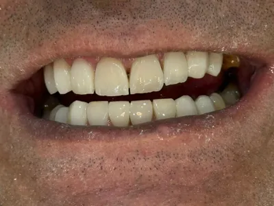 بهترین دندانپزشک زیبایی شیراز