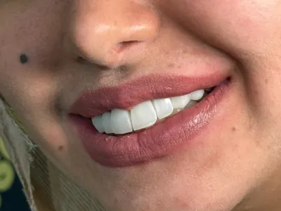 بهترین دندانپزشک زیبایی شیراز