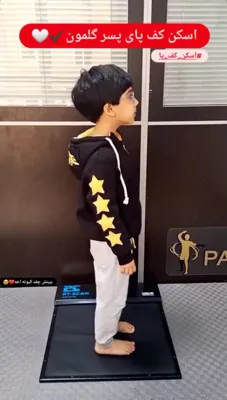 اسکن کف پا کودکان