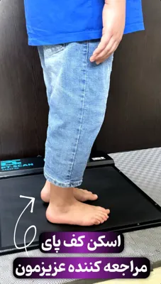 اسکن کف پا در شهرک غرب