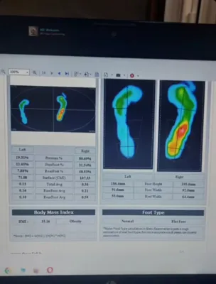 مرکز اسکن کف پا در شهرک غرب تهران