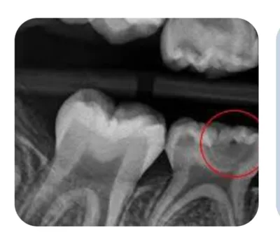 درمان اصولی