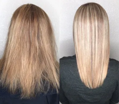 بهترین مرکز احیای مو در تهرانسر