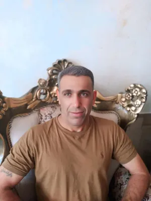 کاشت مو تضمینی در شیراز