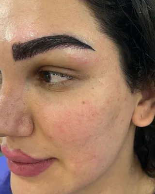 کاشت مو تضمینی در شیراز