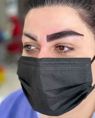 کاشت مو تضمینی در شیراز