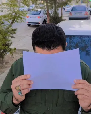 کاشت مو تضمینی در شیراز