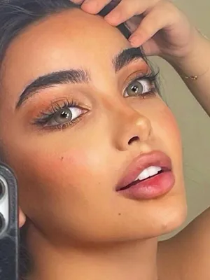 تزریق فیلر اصفهان