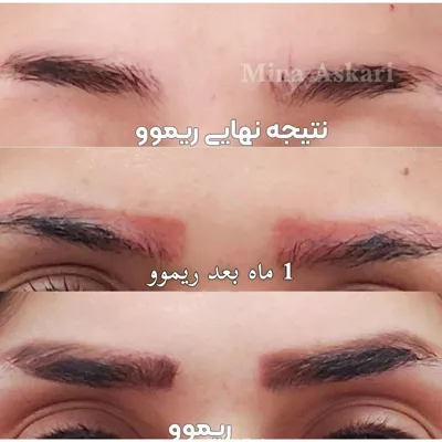 ریمو تاتو در غرب تهران