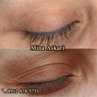 ریمو تتو غرب تهران