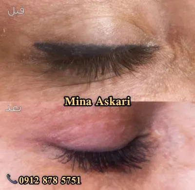 ریمو تتو غرب تهران