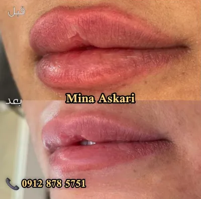 ریمو تتو غرب تهران