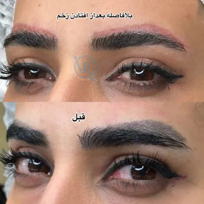 ریمو تتو غرب تهران