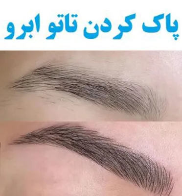 ریمو تتو غرب تهران