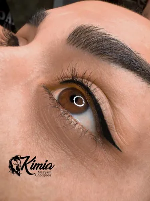 میکروبلیدینگ و شیدینگ لب تهران