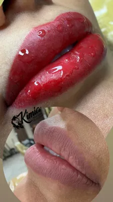 میکروبلیدینگ در تهران