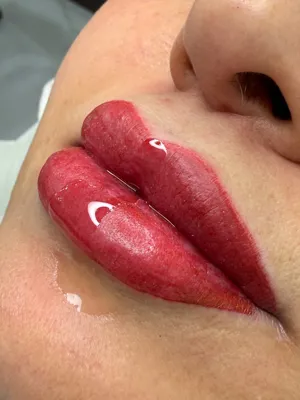 میکروبلیدینگ تهران