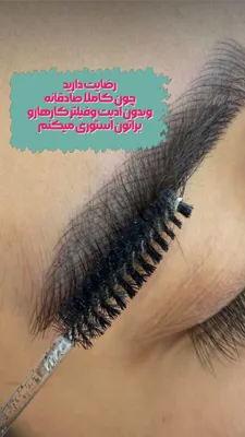 میکروبلیدینگ در فلاح تهران