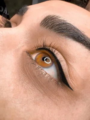 میکروبلیدینگ در ابوذر تهران