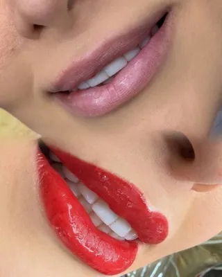 میکروبلیدینگ در فلاح و ابوذر تهران