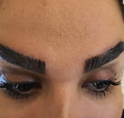 کلینیک کاشت موی آتیه