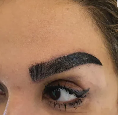 کلینیک کاشت موی آتیه