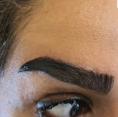 کلینیک کاشت موی آتیه