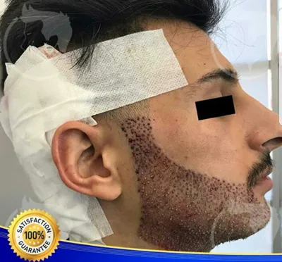 کلینیک کاشت موی آتیه