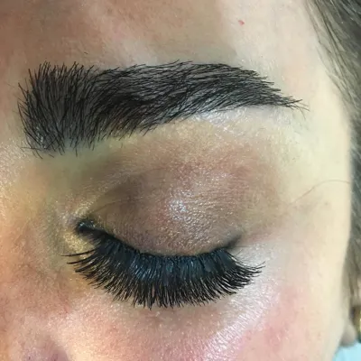 کلینیک کاشت موی آتیه