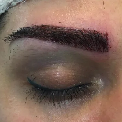 کلینیک کاشت موی آتیه