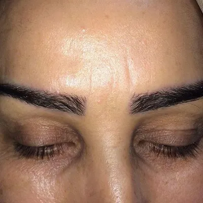 کلینیک کاشت موی آتیه