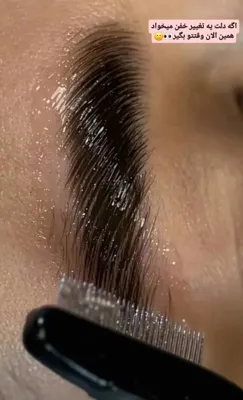 لیفت ایرو در مشیریه