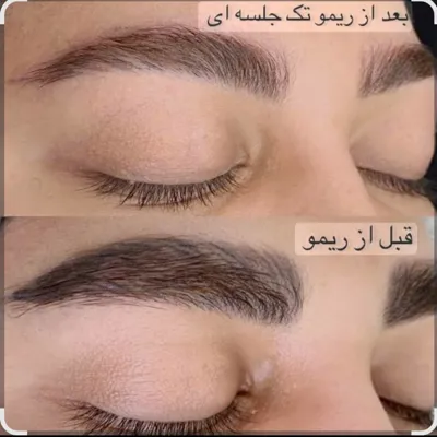 خدمات تخصصی آرایش دائم