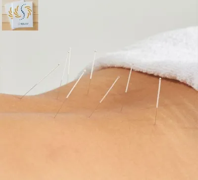 حجامت امبدینگ طب سوزنی در اصفهان 