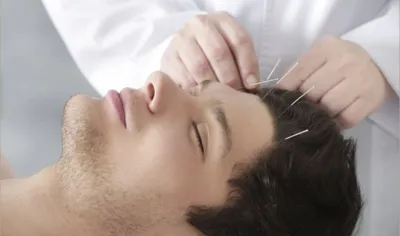 حجامت امبدینگ طب سوزنی در اصفهان 