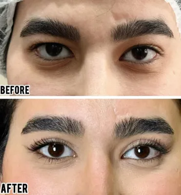 بلفاروپلاستی،لیفت صورت،کاشت مو در اصفهان 