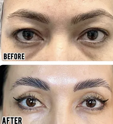 بلفاروپلاستی،لیفت صورت،کاشت مو در اصفهان 