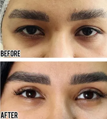 بلفاروپلاستی،لیفت صورت،کاشت مو در اصفهان 