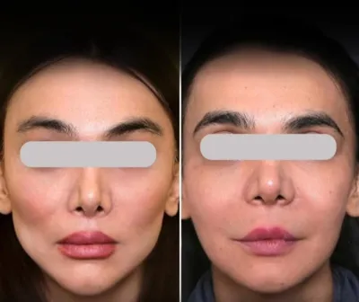 بلفاروپلاستی،لیفت صورت،کاشت مو در اصفهان 