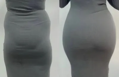 


لیفت بادی بوتاکس در اصفهان

لیفت باسن در اصفهان 


