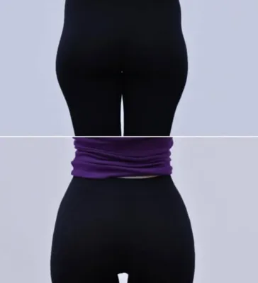 تزریق فیلر بادی در اصفهان 