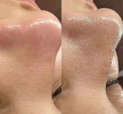 فشیال تخصصی در اصفهان 