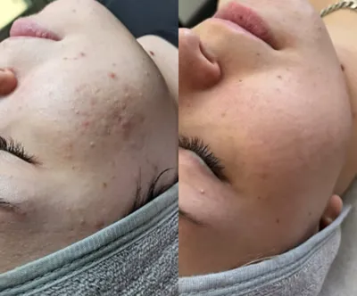 فشیال تخصصی در اصفهان