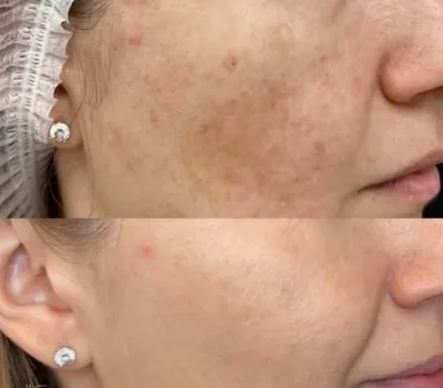 فشیال تخصصی در اصفهان