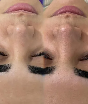 فشیال تخصصی در اصفهان