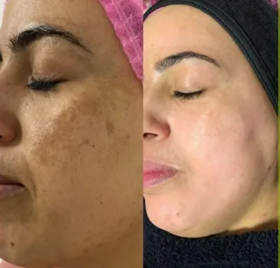 فشیال تخصصی در اصفهان